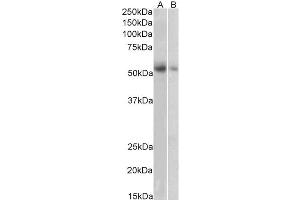 ABIN570915 (1µg/ml) staining of Human Placenta (A) and Human Adrenal Gland (B) lysate (35µg protein in RIPA buffer).