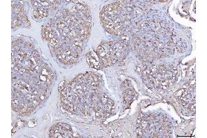 IHC analysis of Pleckstrin/PLEK using anti-Pleckstrin/PLEK antibody (ABIN7601814). (Pleckstrin anticorps  (AA 47-308))