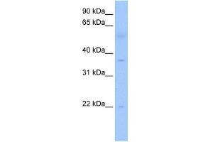 RG9MTD3 antibody used at 1 ug/ml to detect target protein. (RG9MTD3 anticorps)