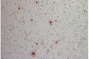 Indirect immunostaining of a PFA fixed, formic acid trated paraffin embedded cortex section from a sporadic Alzheimer´s disease patient (dilution 1 : 200).