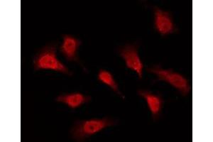ABIN6276016 staining Hela by IF/ICC. (GPR153 anticorps  (Internal Region))