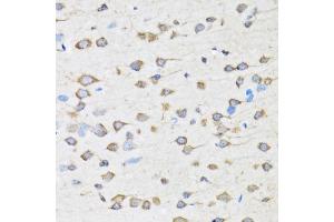 Immunohistochemistry of paraffin-embedded rat brain using COPB2 antibody (ABIN5974232) at dilution of 1/100 (40x lens). (COPB2 anticorps)
