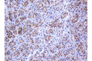 anti-Galactosidase, beta 1 (GLB1) antibody