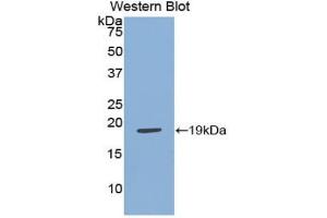 Western blot analysis of the recombinant protein. (Adrenomedullin anticorps  (AA 31-187))