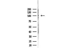 Western blot analysis of lysates from PC12 cells(starvation 24h treatment), using Phospho-NF kappaB p105/p50 (Ser932) Antibody at 1/1000 dilution.