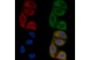 ALG6 Mouse Monoclonal Antibody staining Hela cells by IF/ICC. (ALG6 anticorps)
