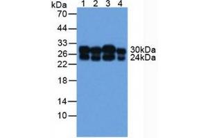 Figure. (COMT anticorps  (AA 52-271))