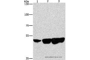 Western blot analysis of Hela, hepG2 and 231 cell, using CTBP2 Polyclonal Antibody at dilution of 1:400 (CTBP2 anticorps)