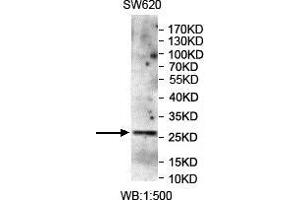 WB analysis of SW620 lysates, using CMTM4 antibody. (CMTM4 anticorps)