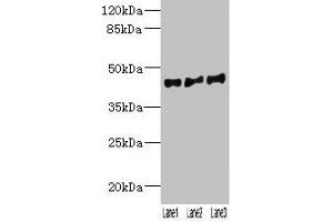 Western blot All lanes: VN1R2 antibody at 2 μg/mL Lane 1: Hela whole cell lysate Lane 2: A549 whole cell lysate Lane 3: HepG2 whole cell lysate Secondary Goat polyclonal to rabbit IgG at 1/10000 dilution Predicted band size: 45 kDa Observed band size: 45 kDa (VN1R2 anticorps  (AA 115-170))