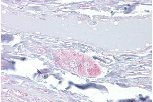 Immunohistochemistry with Small intestine, submucosal plexus tissue at an antibody concentration of 10µg/ml using anti-DPYSL3 antibody (ARP51962_P050)