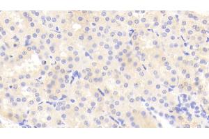 Detection of TNC in Human Kidney Tissue using Polyclonal Antibody to Tenascin C (TNC)