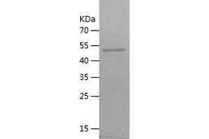 Western Blotting (WB) image for V-Set Domain Containing T Cell Activation Inhibitor 1 (VTCN1) (AA 31-258) protein (His-IF2DI Tag) (ABIN7125685)