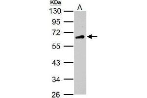 WB Image Sample (30 ug of whole cell lysate) A: U87-MG 10% SDS PAGE antibody diluted at 1:1000 (CAMKK2 anticorps  (N-Term))