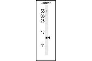 Western blot analysis of H2AFZ Antibody (C-term) in Jurkat cell line lysates (35ug/lane). (H2AFZ anticorps  (C-Term))