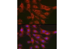 anti-Phosphoribosylglycinamide Formyltransferase (GART) (AA 1-320) antibody