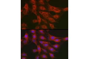 Immunofluorescence analysis of C6 cells using GART Rabbit pAb (ABIN1679954, ABIN3018225, ABIN3018226 and ABIN6220407) at dilution of 1:200 (40x lens). (GART anticorps  (AA 1-320))