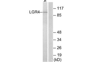Western blot analysis of extracts from Jurkat cells, using LGR4 antibody. (LGR4 anticorps  (Internal Region))