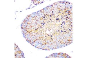 Immunohistochemistry of paraffin-embedded mouse testis using Integrin alpha 4 (ITG/CD49d) (ITG/CD49d) Rabbit mAb (054) at dilution of 1:100 (40x lens).