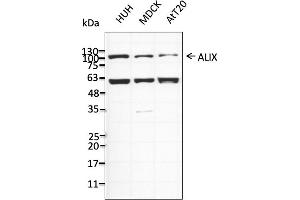 Western Blotting (WB) image for anti-Programmed Cell Death 6 Interacting Protein (PDCD6IP) (C-Term) antibody (ABIN7273068) (ALIX anticorps  (C-Term))