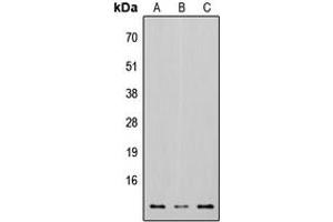 Western blot analysis of Osteocalcin expression in HEK293T (A), Raw264. (Osteocalcin anticorps  (Center))