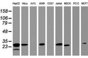 Western Blotting (WB) image for anti-Hydroxysteroid (17-Beta) Dehydrogenase 8 (HSD17B8) (AA 57-261) antibody (ABIN2715557) (HSD17B8 anticorps  (AA 57-261))