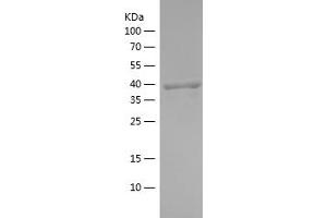 Western Blotting (WB) image for Flotillin 1 (FLOT1) (AA 107-253) protein (His-IF2DI Tag) (ABIN7122982)