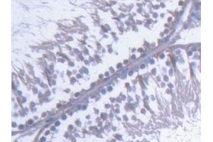 Detection of KTN1 in Rat Testis Tissue using Polyclonal Antibody to Kinectin 1 (KTN1) (KTN1 anticorps  (AA 1162-1325))