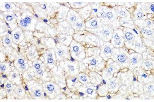 Immunohistochemistry of paraffin-embedded Mouse liver using BMPR1B Polyclonal Antibody at dilution of 1:200 (40x lens).