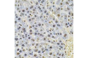 Immunohistochemistry of paraffin-embedded rat liver using PSMC3 Antibody (ABIN5971034) at dilution of 1/100 (40x lens). (PSMC3 anticorps)