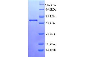 SDS-PAGE (SDS) image for Ring Finger Protein 7 (RNF7) (AA 2-113) protein (GST tag) (ABIN5710264) (RNF7 Protein (AA 2-113) (GST tag))