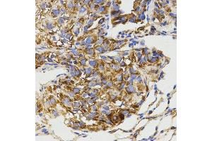 Immunohistochemistry (IHC) image for anti-Glutamate Receptor, Metabotropic 8 (GRM8) antibody (ABIN3017086) (GRM8 anticorps)