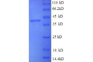 VP2 (AA 2-351) protein (His-SUMO Tag)