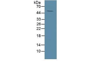 Rabbit Detection antibody from the kit in WB with Positive Control: Human tibia lysate. (MMP13 Kit CLIA)