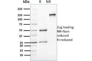 SDS-PAGE Analysis Purified Involucrin Mouse Monoclonal Antibody (SPM259). (Involucrin anticorps)