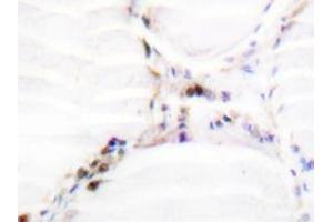 Immunohistochemistry analysis of Vitamin D3 receptor / NR1I1 antibody in paraffin-embedded human thyroid gland tissue. (Vitamin D Receptor anticorps)