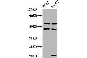 Western Blot Positive WB detected in: K562 whole cell lysate, HepG2 whole cell lysate All lanes: GATB antibody at 3. (PET112L anticorps  (AA 301-383))