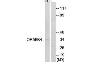 Western blot analysis of extracts from COLO cells, using OR56B4 antibody. (OR56B4 anticorps  (C-Term))