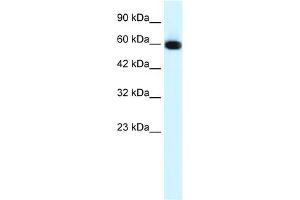 WB Suggested Anti-GLIS2 Antibody Titration:  0. (GLIS2 anticorps  (N-Term))