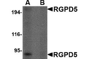 Western Blotting (WB) image for anti-RANBP2-Like and GRIP Domain Containing 5 (RGPD5) (Middle Region) antibody (ABIN1031059) (RGPD5 anticorps  (Middle Region))