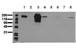 Western Blotting (WB) image for anti-Receptor tyrosine-protein kinase erbB-2 (ErbB2/Her2) (AA 860-880) antibody (ABIN126788) (ErbB2/Her2 anticorps  (AA 860-880))