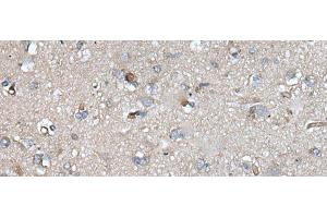 anti-Uridine Monophosphate Synthetase (UMPS) antibody