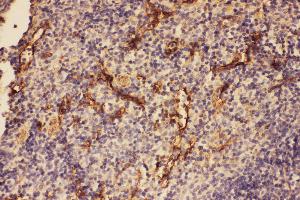 Anti-C5/C5a antibody, IHC(P) IHC(P): Mouse Spleen Tissue