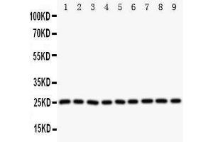 Western Blotting (WB) image for anti-Superoxide Dismutase 2, Mitochondrial (SOD2) (AA 45-62), (N-Term) antibody (ABIN3044165) (SOD2 anticorps  (N-Term))