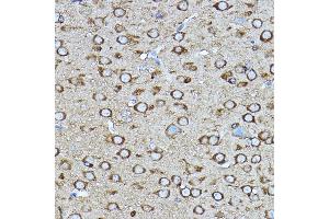 Immunohistochemistry of paraffin-embedded mouse brain using [KO Validated] CRMP2/CRMP2/DPYSL2 Rabbit pAb (ABIN7266769) at dilution of 1:400 (40x lens).