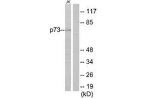 Western blot analysis of extracts from Jurkat cells, using p73 Antibody. (Tumor Protein p73 anticorps  (AA 271-320))