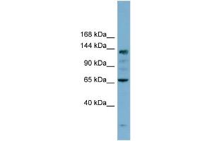 WB Suggested Anti-IARS Antibody Titration: 0. (IARS anticorps  (N-Term))
