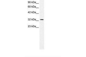 Image no. 2 for anti-Small Nuclear RNA Activating Complex, Polypeptide 2, 45kDa (SNAPC2) (AA 197-246) antibody (ABIN6736271) (SNAPC2 anticorps  (AA 197-246))