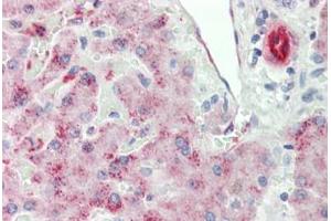 Human Liver: Formalin-Fixed, Paraffin-Embedded (FFPE)