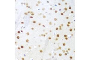Immunohistochemistry of paraffin-embedded mouse brain using UNG antibody at dilution of 1:100 (40x lens). (UNG anticorps)